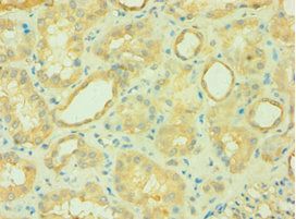 CARD10 Antibody