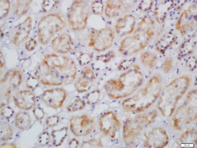 CARD10 Rabbit Polyclonal Antibody
