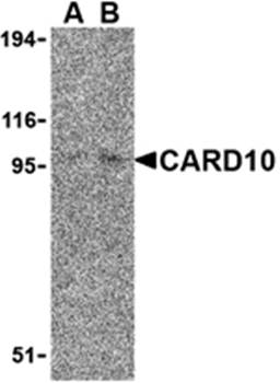 CARD10 Antibody