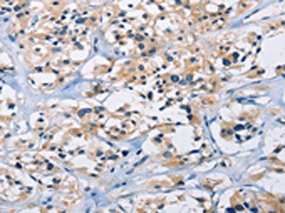 CARD14 Antibody
