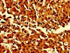 CARD14 Antibody