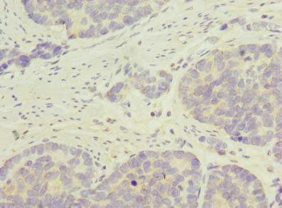 CARD19 Antibody