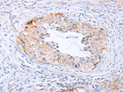 CARD6 Antibody