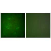 CARD6 Antibody