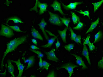 CARD6 Antibody
