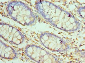 CARD8 Antibody