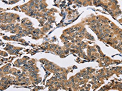 CARD8 Antibody