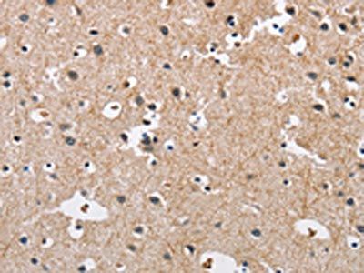 CARD8 Antibody