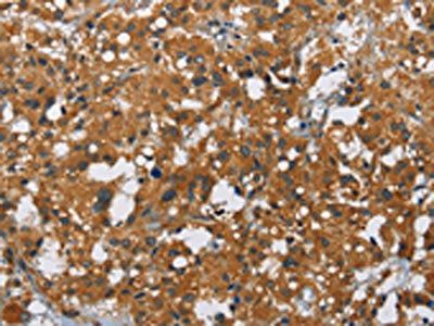 CARD9 Antibody