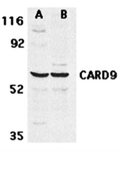 CARD9 Antibody