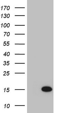 Cardiac Troponin T Antibody