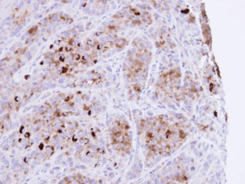 CRHSP-24 Rabbit Polyclonal Antibody