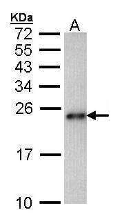 CRHSP-24 Rabbit Polyclonal Antibody