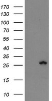 CARKL (SHPK) antibody