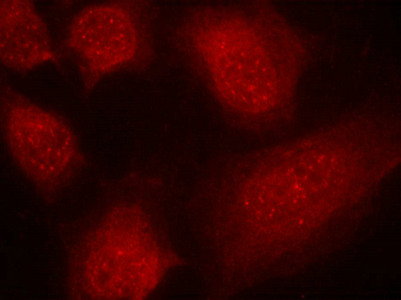 CARM1 (Ab-228) antibody