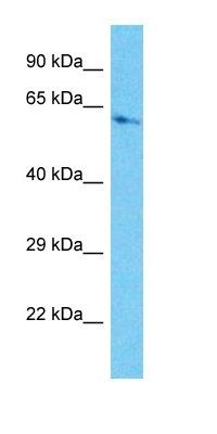 CARM1 antibody