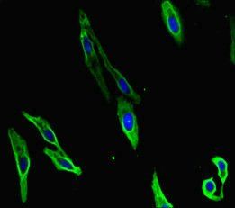 CARM1 antibody