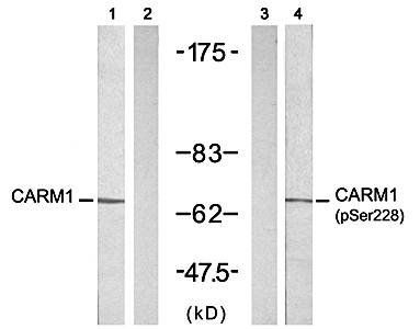 CARM1 (Ab-228) Antibody