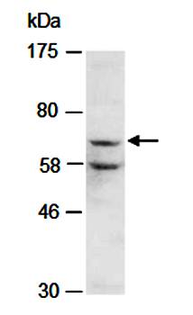 CARM1 antibody