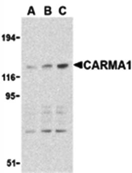 CARMA1 Antibody