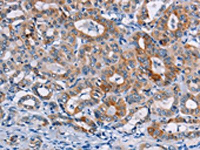 CASC3 Antibody