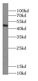 Casein Kinase 1 delta antibody