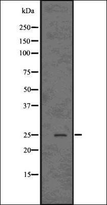 Casein Kinase 2 beta antibody