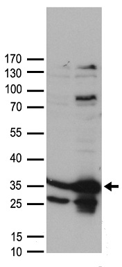 Casein Kinase 2 beta (CSNK2B) antibody