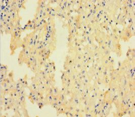 CASK Antibody