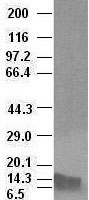 CASKIN2 Antibody