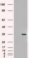 CASKIN2 Antibody