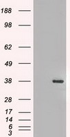 CASKIN2 antibody