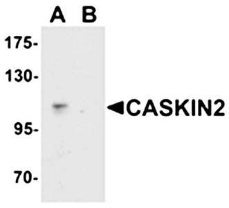 CASKIN2 Antibody