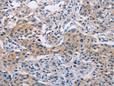 CASP10 antibody