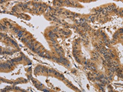 CASP10 antibody