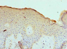 CASP14 Antibody