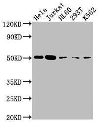 CASP2 Recombinant Monoclonal Antibody