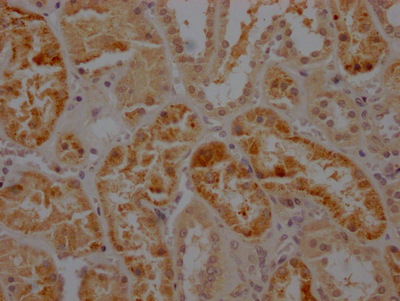 CASP2 Recombinant Monoclonal Antibody