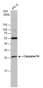 caspase 14 Antibody