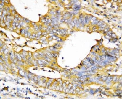 Anti-Caspase-1(P20)/CASP1 Antibody