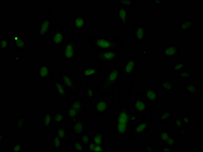 CASP3 Recombinant Monoclonal Antibody