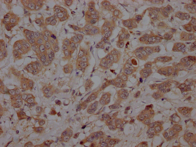 CASP3 Recombinant Monoclonal Antibody