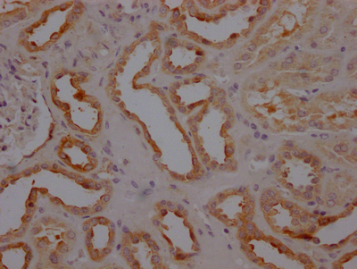 Caspase 3 antibody