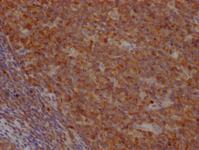 CASP3 Recombinant Monoclonal Antibody