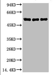 CASP8 Monoclonal Antibody