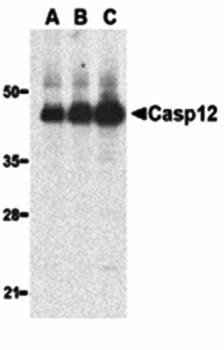 Caspase2 Antibody (Large)
