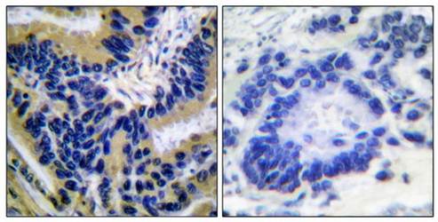 Caspase 3 (Cleaved-Asp175) Antibody