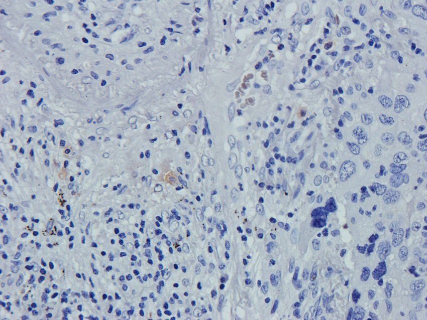 Caspase 3 antibody