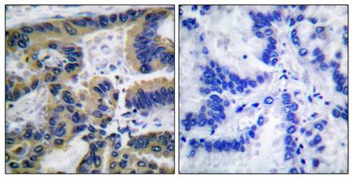 Caspase 7 (Cleaved-Asp198) Antibody