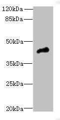 CASQ1 antibody